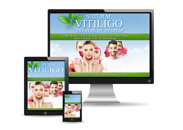 Natural Vitiligo Treatment System Benefits