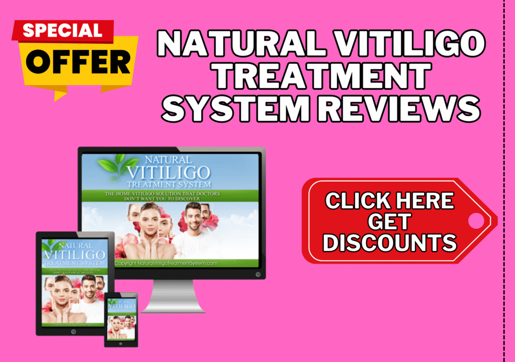 Natural Vitiligo Treatment System reviews